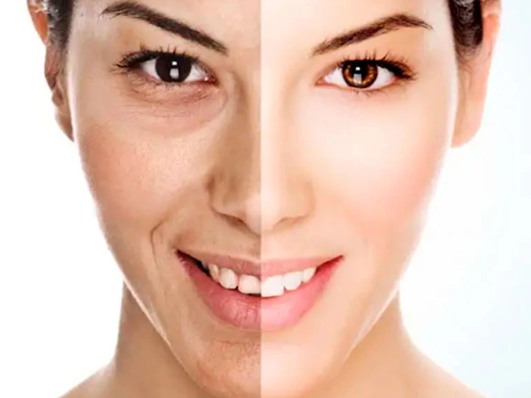 سم زدایی پوست - پاکسازی صورت - درمان جوش صورت در کرج - بهترین کلینیک تخصصی زیبایی - خدمات لیزر در کرج - شماره تماس: 02632242647 - 09353242647
